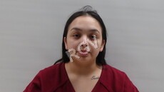 Gonzalez, Alexis